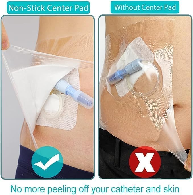 12"x13.7" Waterproof Shower Cover Incision Bandages for Large Wound with No Glue On The Center Adhesive Transparent Shower Protector Post Surgical Water Barrier Guard Pack of 14